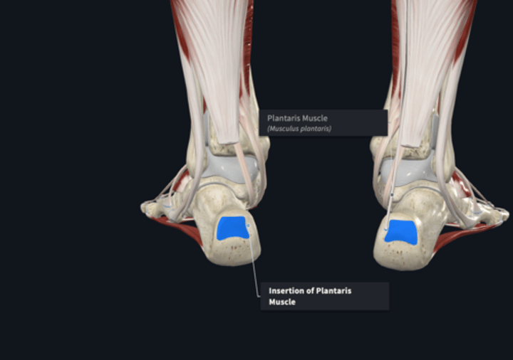 <p>Insertion: Gastrocnemius</p>