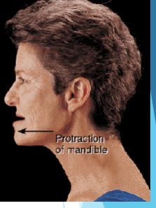 <p>Moving a part forwards</p>