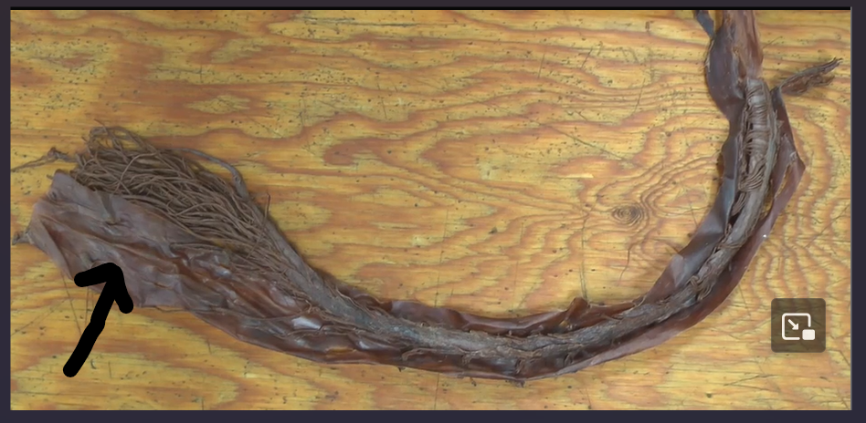 <p>The outermost layer of the meninges.</p>