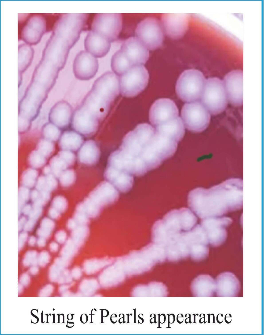 <p>String of Pearls appearance</p><p>Agar + 0.5 - 0.50 u/ml of Penicillin</p><p>Cells: Spherical</p>