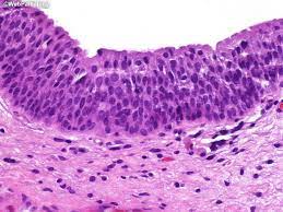<p>the epithelium lining the urinary tract including the bladder, ureter, and major calyces of the kidney</p>