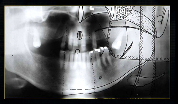 <p>real hard tissue shadows </p>