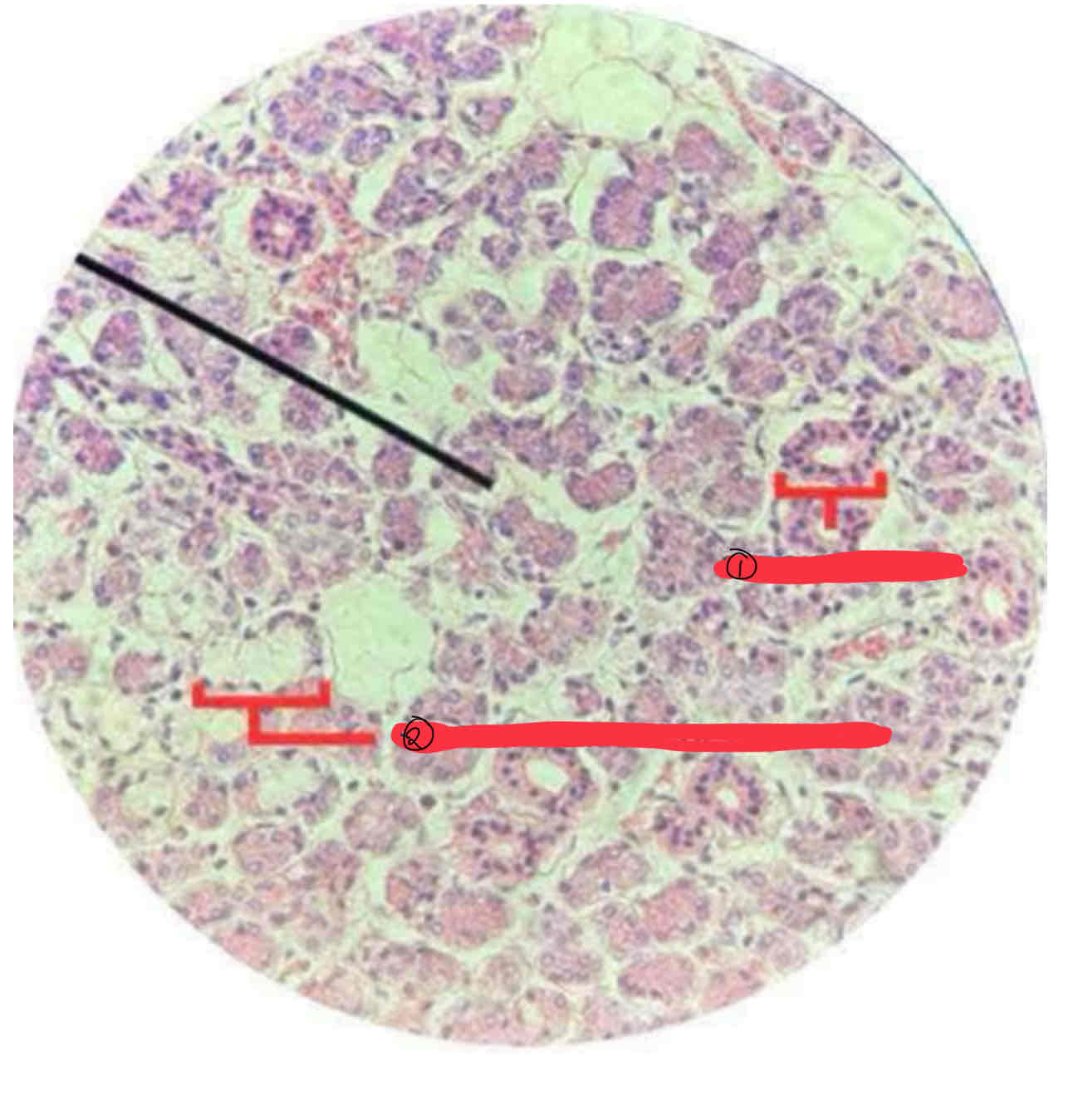 <p>Sublingual Gland</p>