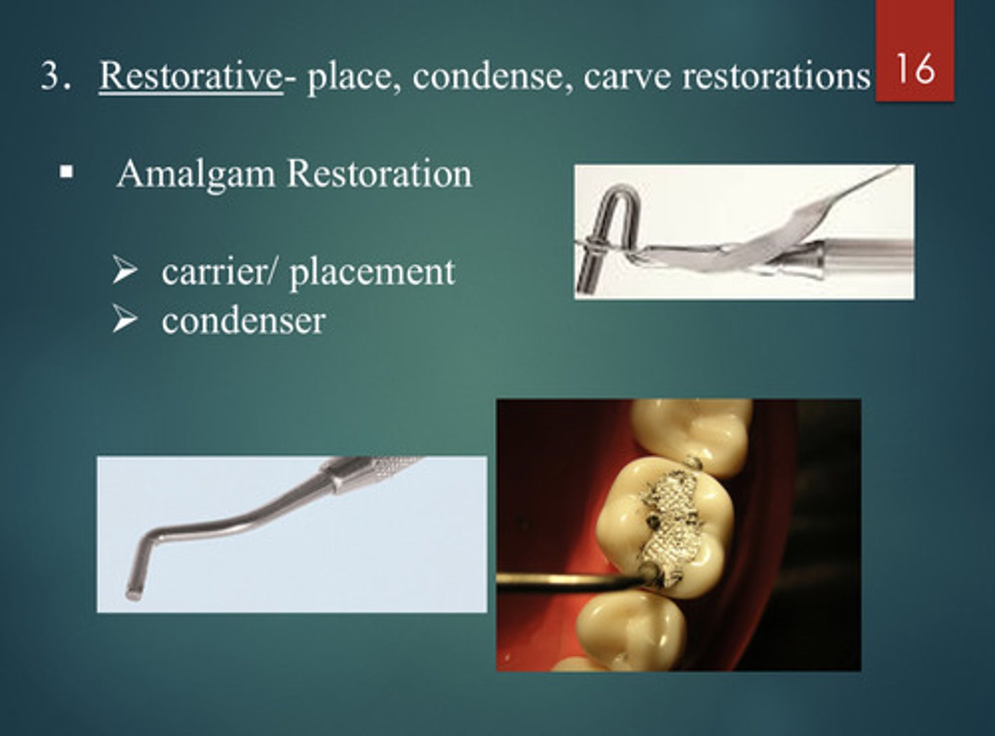 <p>- place, condense, carve restorations</p><p>- condenser</p><p>- carrier/placement</p>