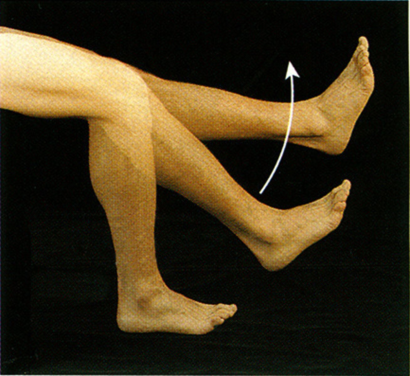 <p>angle increasing between 2 bones</p>