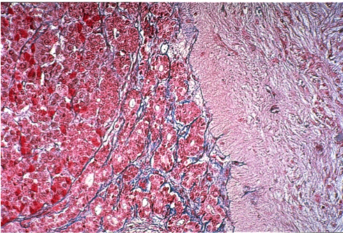 <p>Which side is posterior pituitary?</p>