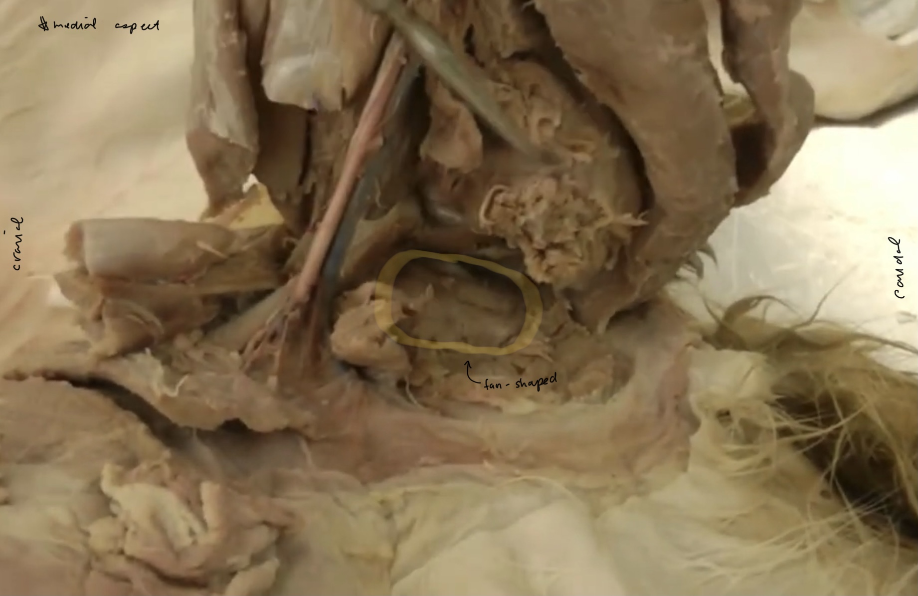 <p>What is the yellow highlighted portion</p>