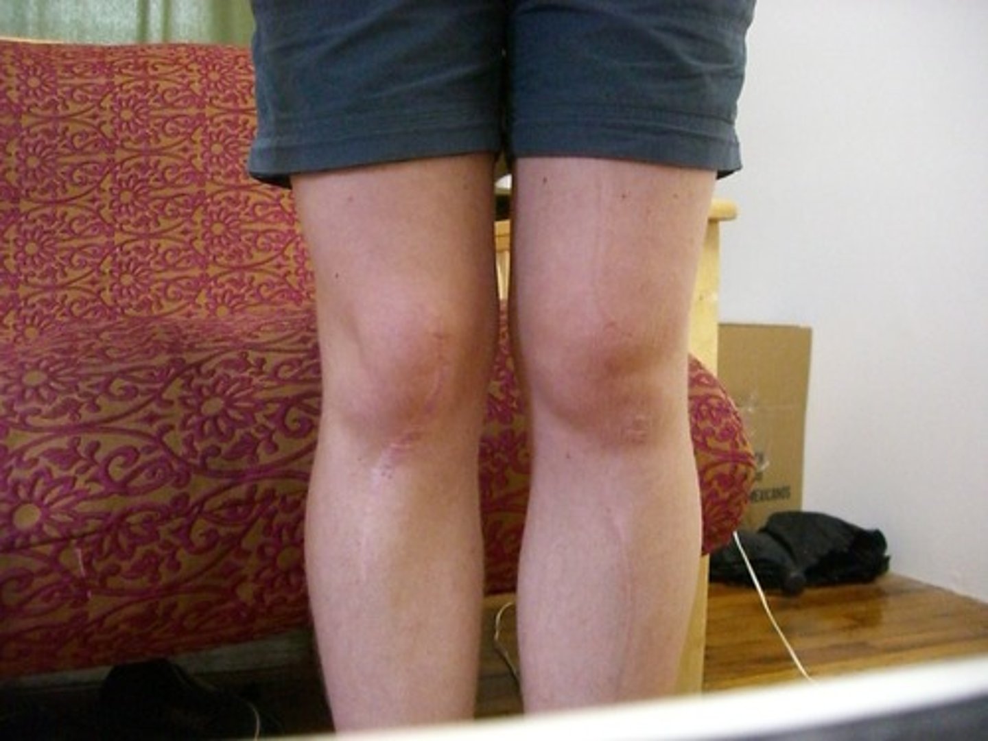 <p>knee</p>