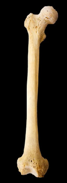 <p>Name this bone.</p><p>(Anterior view, right side).</p>