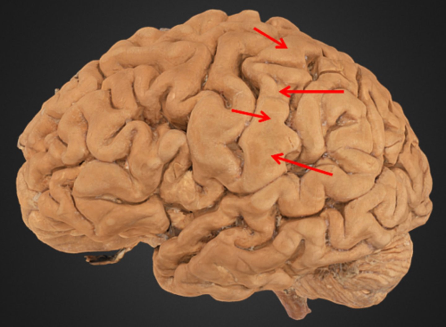 <p>located in the parietal lobe, just posterior to the central sulcus. Location of the primary sensory cortex.</p>