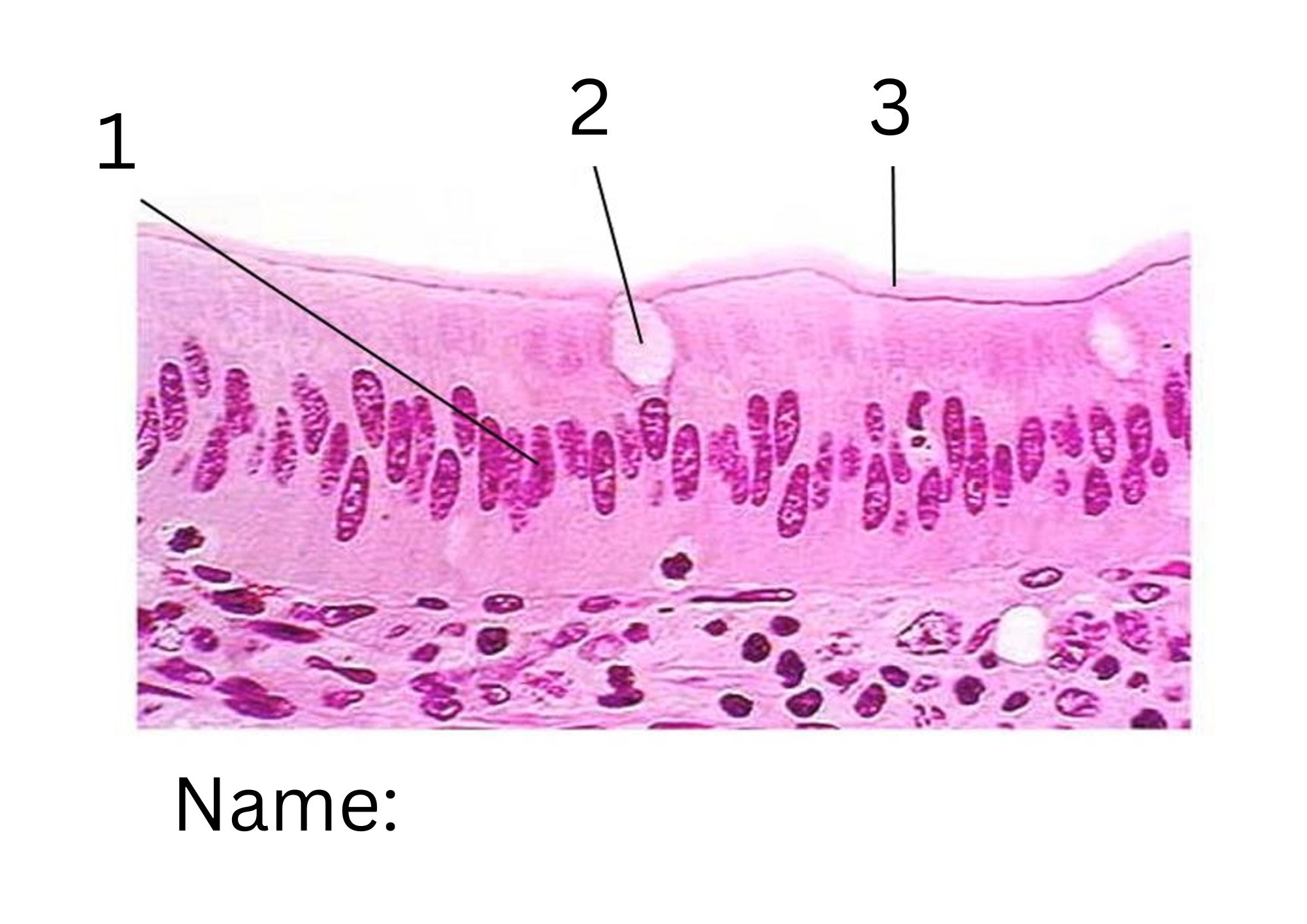 term image
