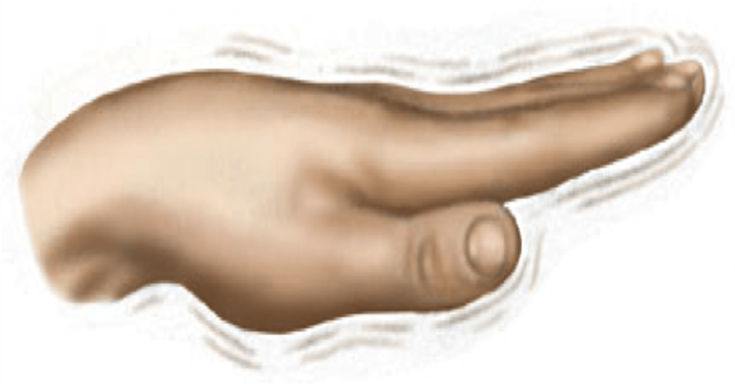 <p>A tremor that occurs as the person holds a body part still.</p>
