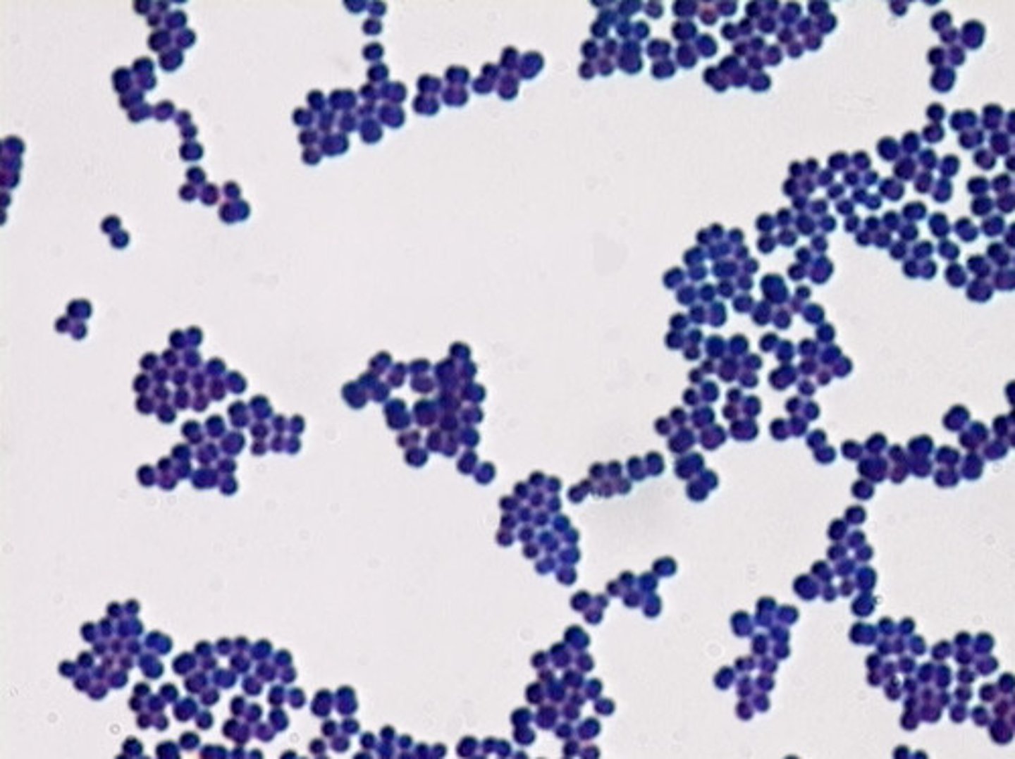 <p>Bacteria that have a thick peptidoglycan cell wall, and no outer membrane (capsule). They stain purple in Gram stain. Easier to treat with antibiotics</p>