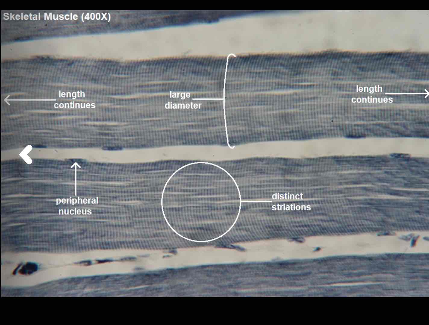 <p>Can you identify this muscle type, a function, location, and a characteristic?</p>