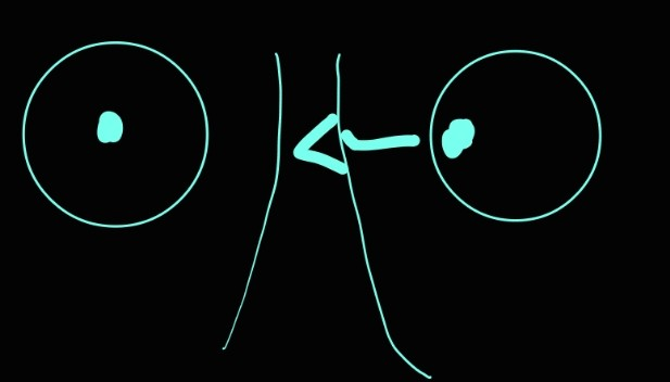 <p>cranial nerve III</p>