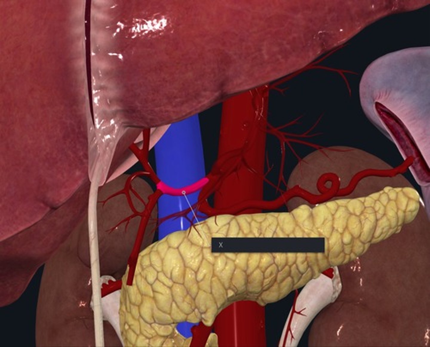 <p>Name the Vessel highlighted pink and marked with the X/ gives rise to the right gastic artery and proper hepatic artery</p>