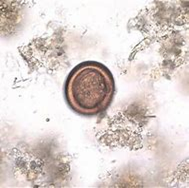 Host: cats
Intermediate host: rats and mice
Location: small intestine
Transmission: ingestion of infective rats or mice
Diagnosis: fecal float seeing proglottids in feces
Treatment: praziquantel
Zoonotic?: no
Common name: feline taeniid or feline tapeworm