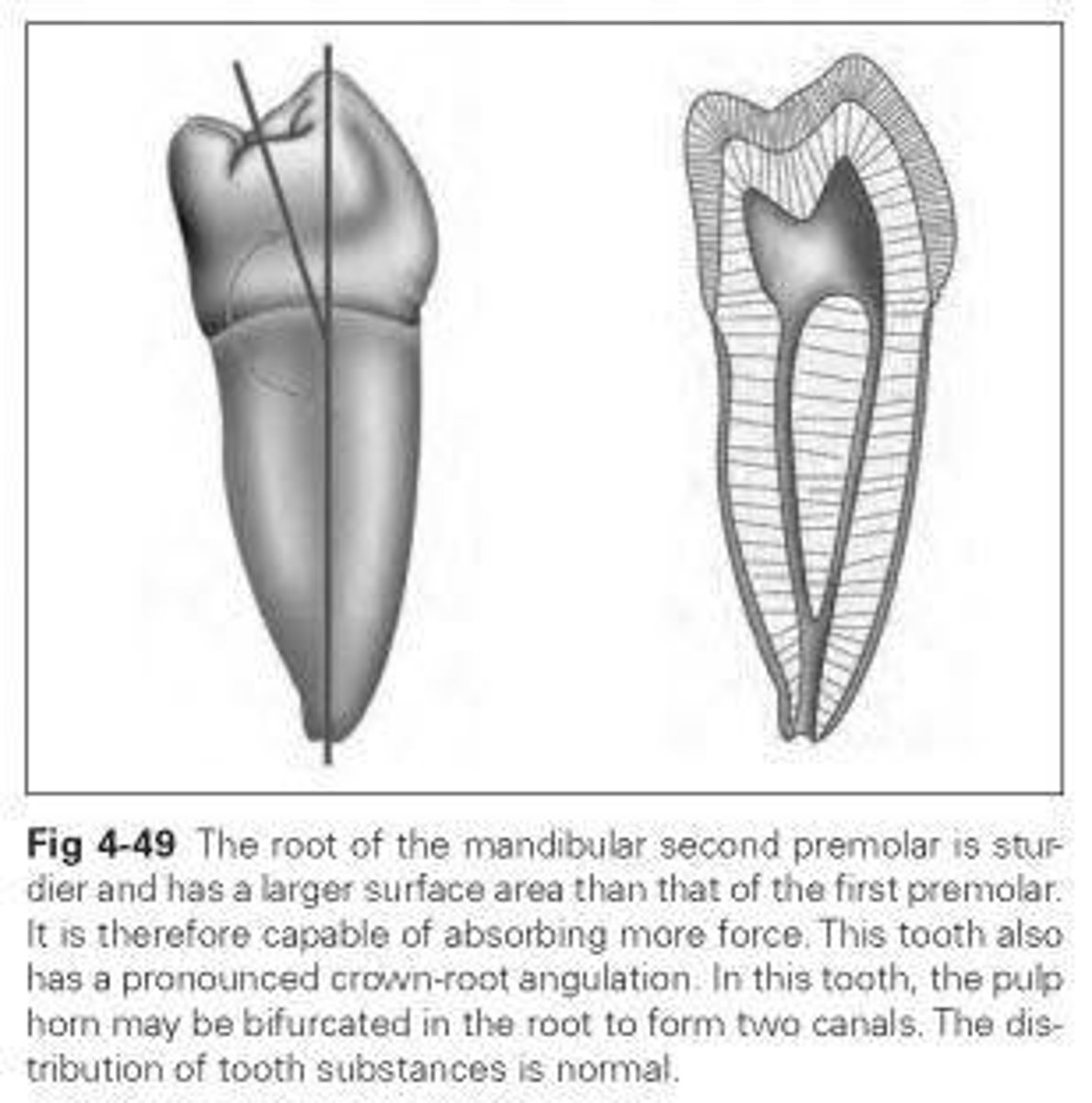 <p>Typically developed from 5 lobes.</p>