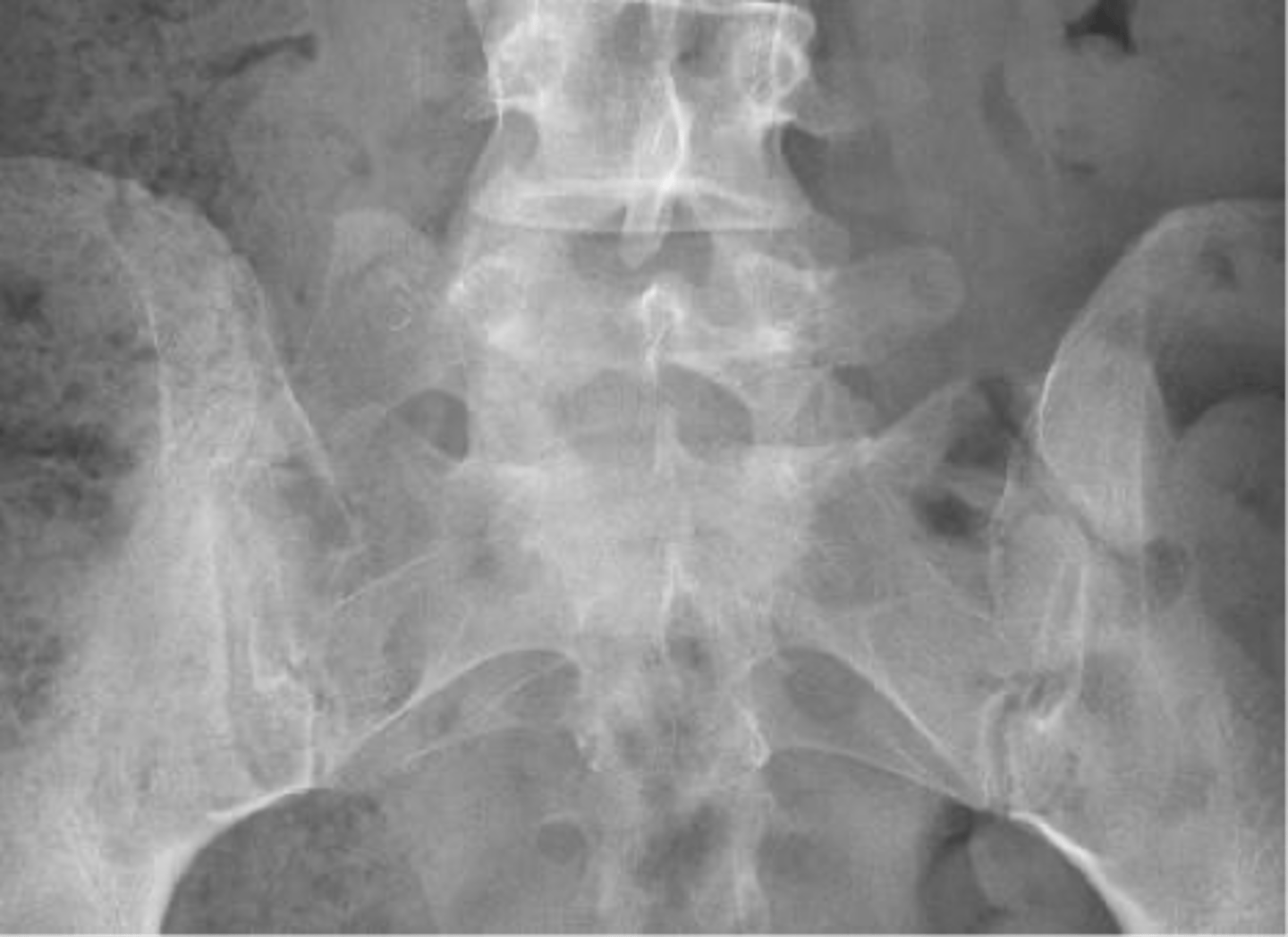 <p>What classification system is used for this diagnosis?</p>