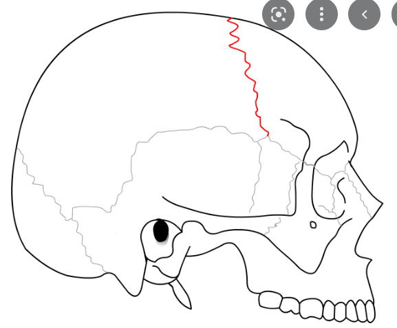 the suture between the parietal and frontal bones of the skull
