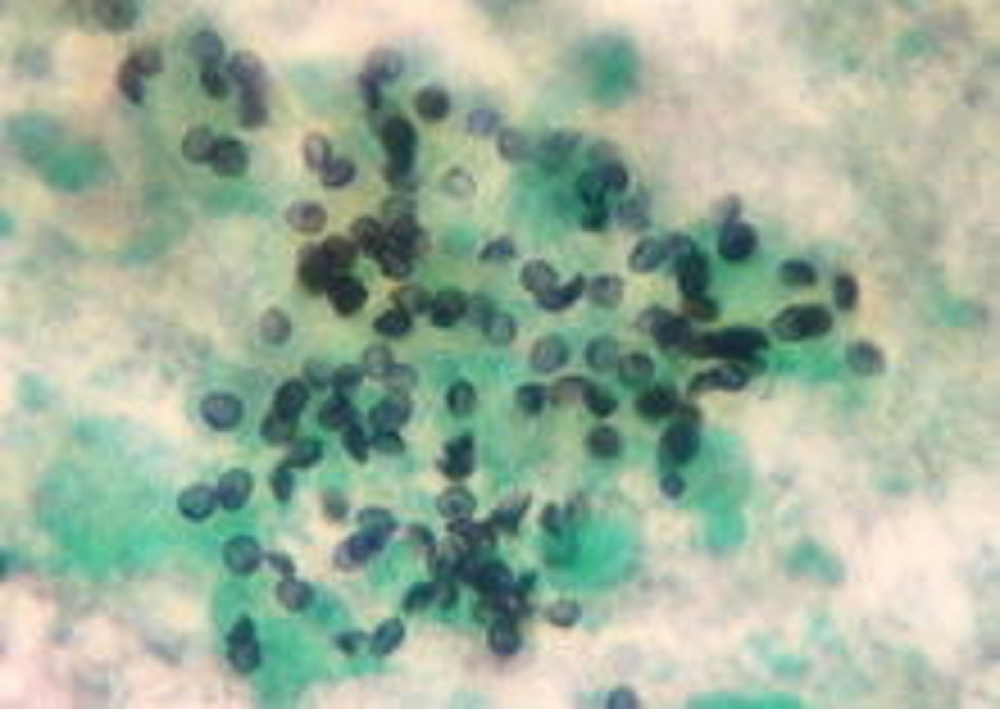 <p>cup-shaped cyst</p>