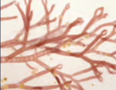<p>central filament buds off short branches that cover it with coricating cells</p>