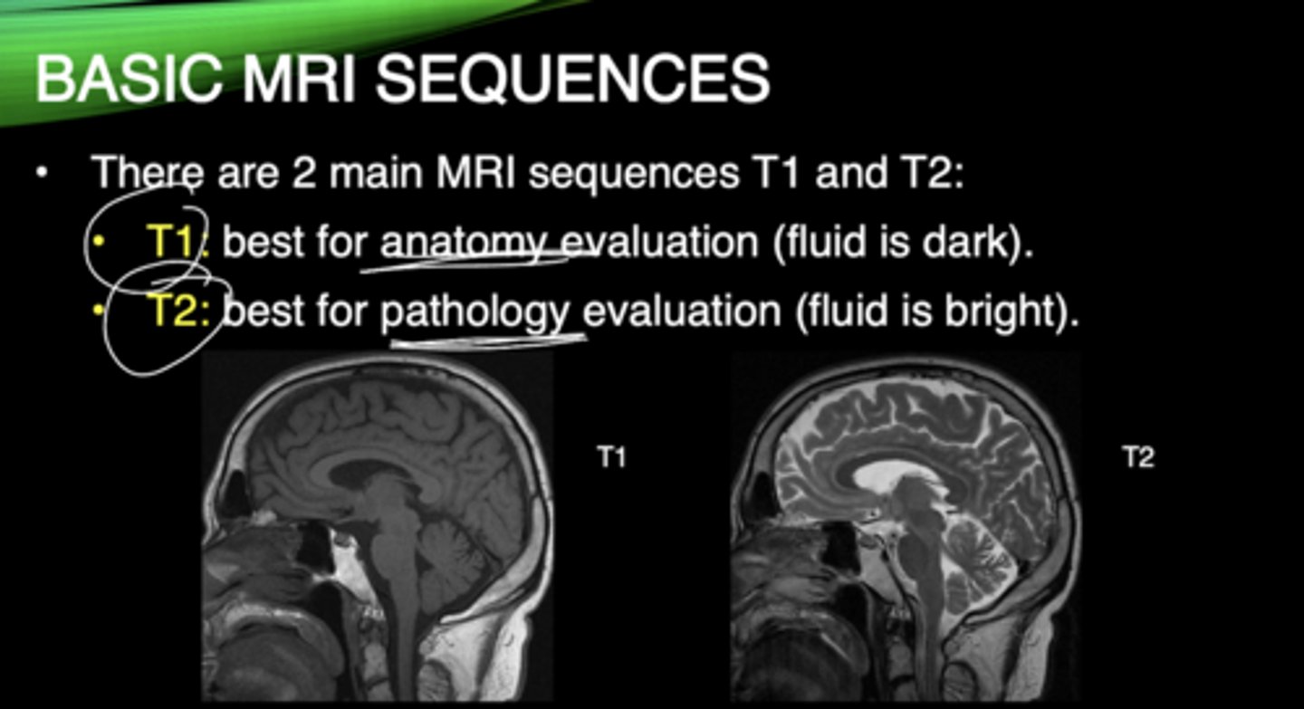 <p>T1 - best for anatomy (fluid is dark)</p><p>T2 - best for pathology (fluid is bright)</p>