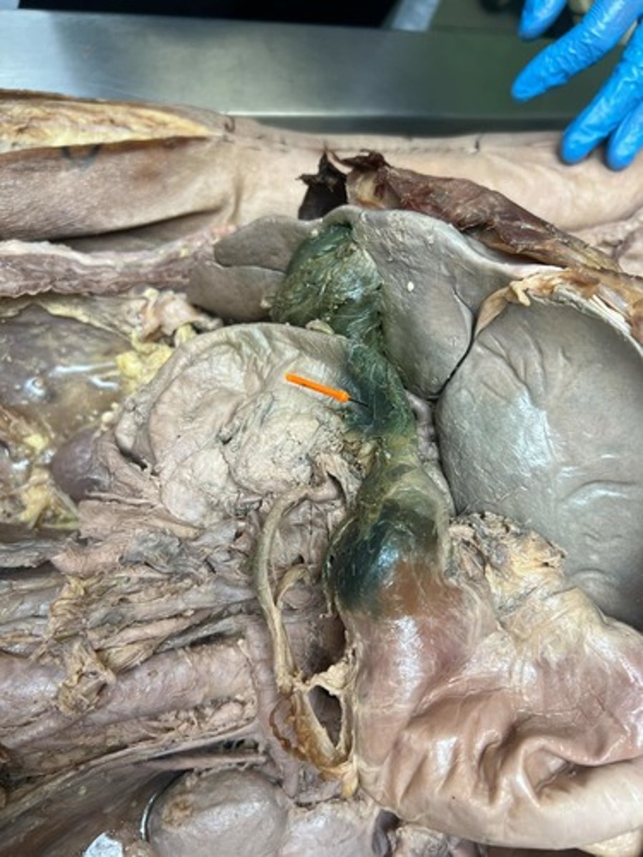 <p>superior part of duodenum</p>