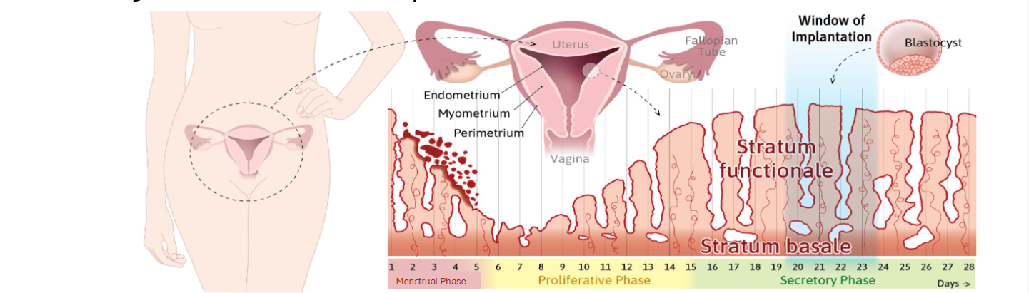 <p><span style="color: rgb(0, 0, 0);"><span>• Shedding of </span><strong><span>functional laye</span></strong><span>r of endometrium</span></span><span style="color: rgb(0, 0, 0);"><br></span><span style="color: rgb(0, 0, 0);"><span>• Triggered by the drop in estrogen/progesterone</span></span><span style="color: rgb(0, 0, 0);"><br></span><span style="color: rgb(0, 0, 0);"><span>• Corpus Luteum</span></span><span style="color: rgb(0, 0, 0);"><br></span><span style="color: rgb(0, 0, 0);"><span>• Spiral arteries constrict → tissue breaks down</span></span><span style="color: rgb(0, 0, 0);"><br></span><span style="color: rgb(0, 0, 0);"><span>•</span><strong><span> Key Idea:</span></strong><span> “Hormone drop = endometrium sheds.”</span></span></p>