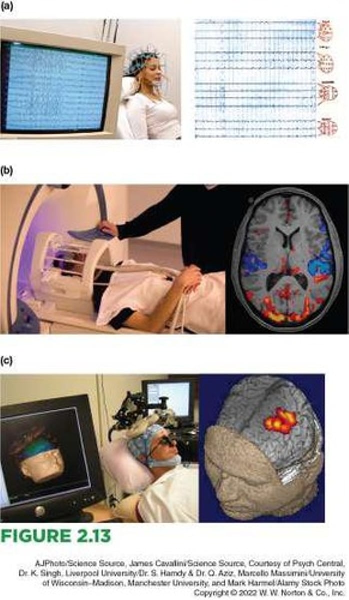 <p>This measurement is useful because different behavioral states produce different and predictable EEG patterns.</p>