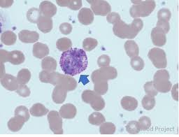 <ul><li><p>10-14 u</p></li><li><p>cytoplasm filled with large, blue-black granules</p></li><li><p>granules may obscure nucleus, water soluble</p></li><li><p>dense nuclear chromatin</p></li><li><p>segmented nucleus</p></li></ul><p></p>