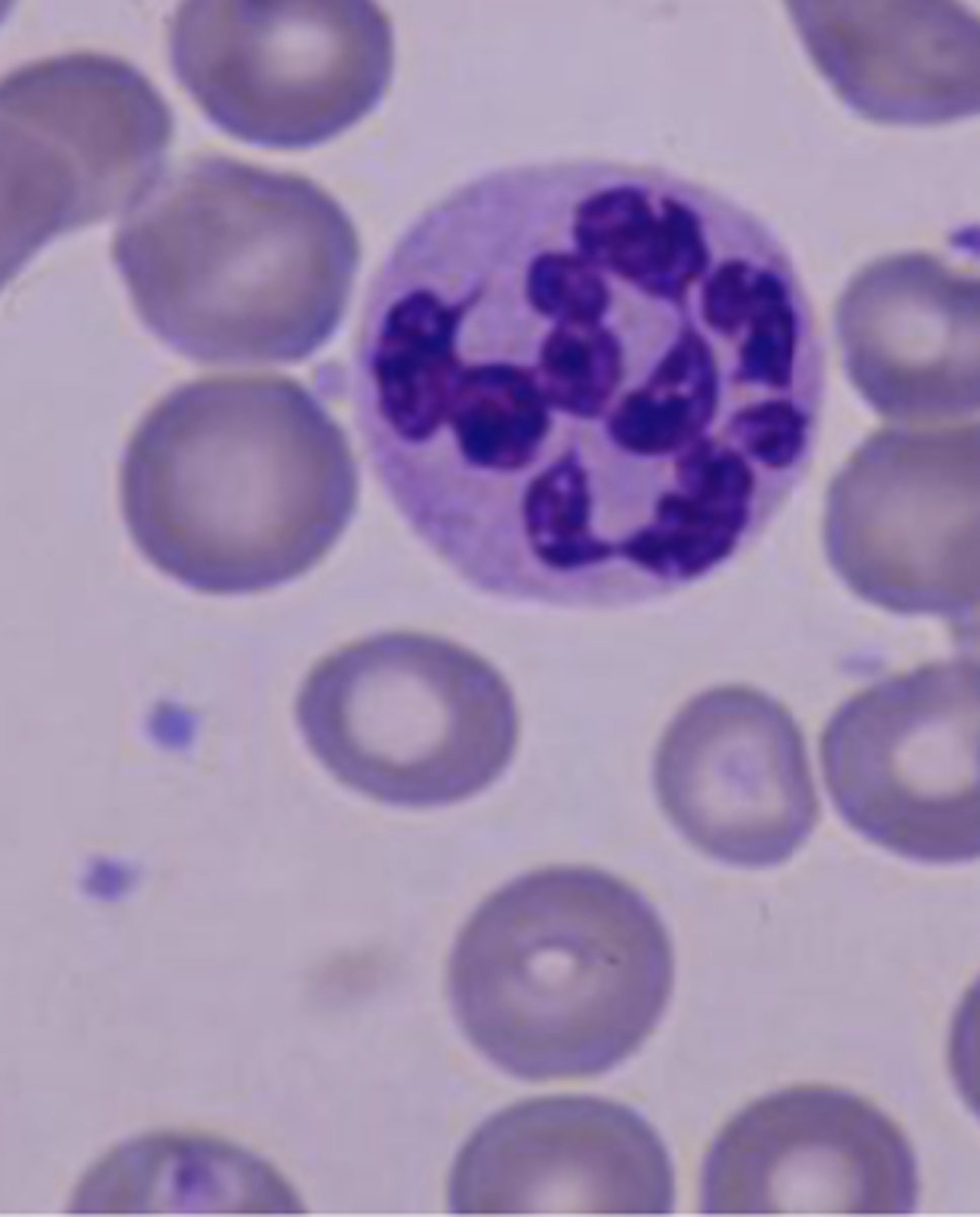 <p>Large nucleated RBCs, hypersegmented neutrophils, large platelets</p>