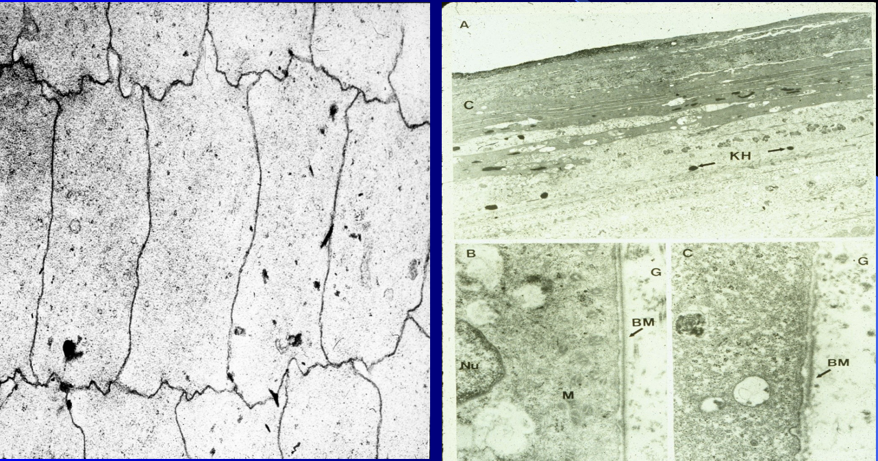 <ul><li><p>some specialized cells in the body intentionally get rid of their nucleus and other internal components</p></li><li><p>the tight boundaries between cells and the lack of a nucleus in the mature cell type becomes clearer or more efficient for specific functions</p></li></ul><p>ex: lens fibers</p>
