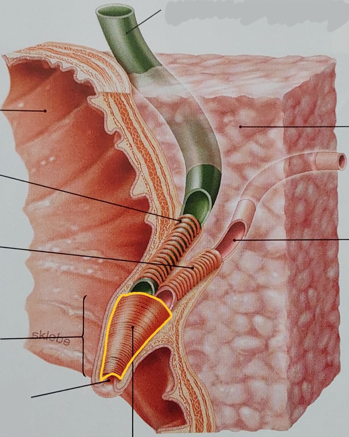 term image
