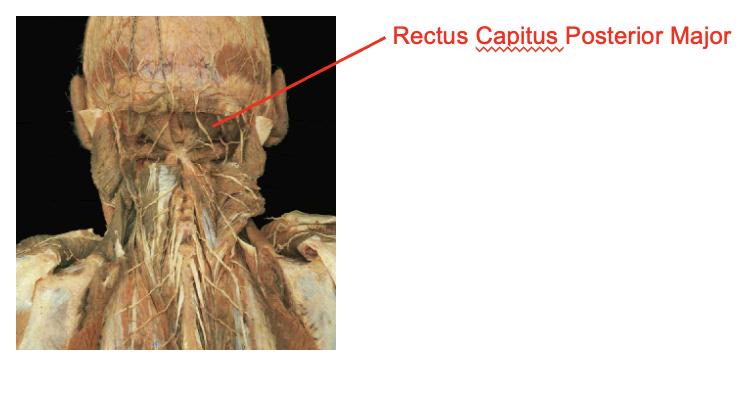 <p>rectus capitus posterior major</p><p>Origi</p><ul><li><p>spinous process of axis</p></li></ul><p>Insertion</p><ul><li><p>extension of the atlano-occuoutak hiubt</p></li><li><p>ipsilateral rotation of the atlano-axial joint</p></li></ul><p></p><img src="https://knowt-user-attachments.s3.amazonaws.com/52a1be24-f733-4357-8aff-2d0fde680c09.png" data-width="100%" data-align="center"><p></p>