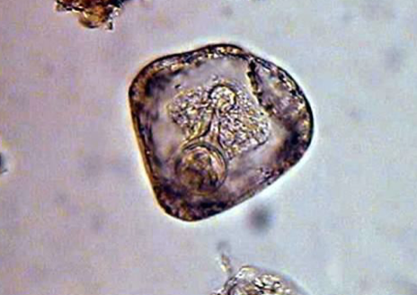 <p>Which parasite is pictured here?</p>