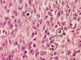 <p>It looks like 'spilled ink' or a 'tangled ball of wool' and indicates active cell division.</p>