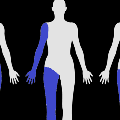<p>Same side of body </p>