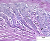 <p>What type of laminitis does this show </p>