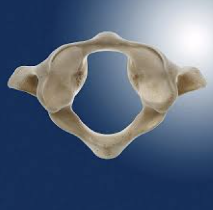 <p>Which vertebrae is this?</p>