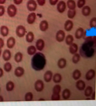 <p>What tissue is this?</p>
