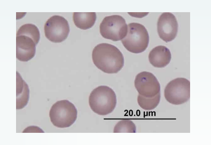 <p>Babesia infecting what species (B. vogeli, B. gibsoni) are found worldwide, are spread by R. sanguineus ticks, and cause intravascular hemolysis, hemolytic anemia, lethargy, fever, and icterus?</p>