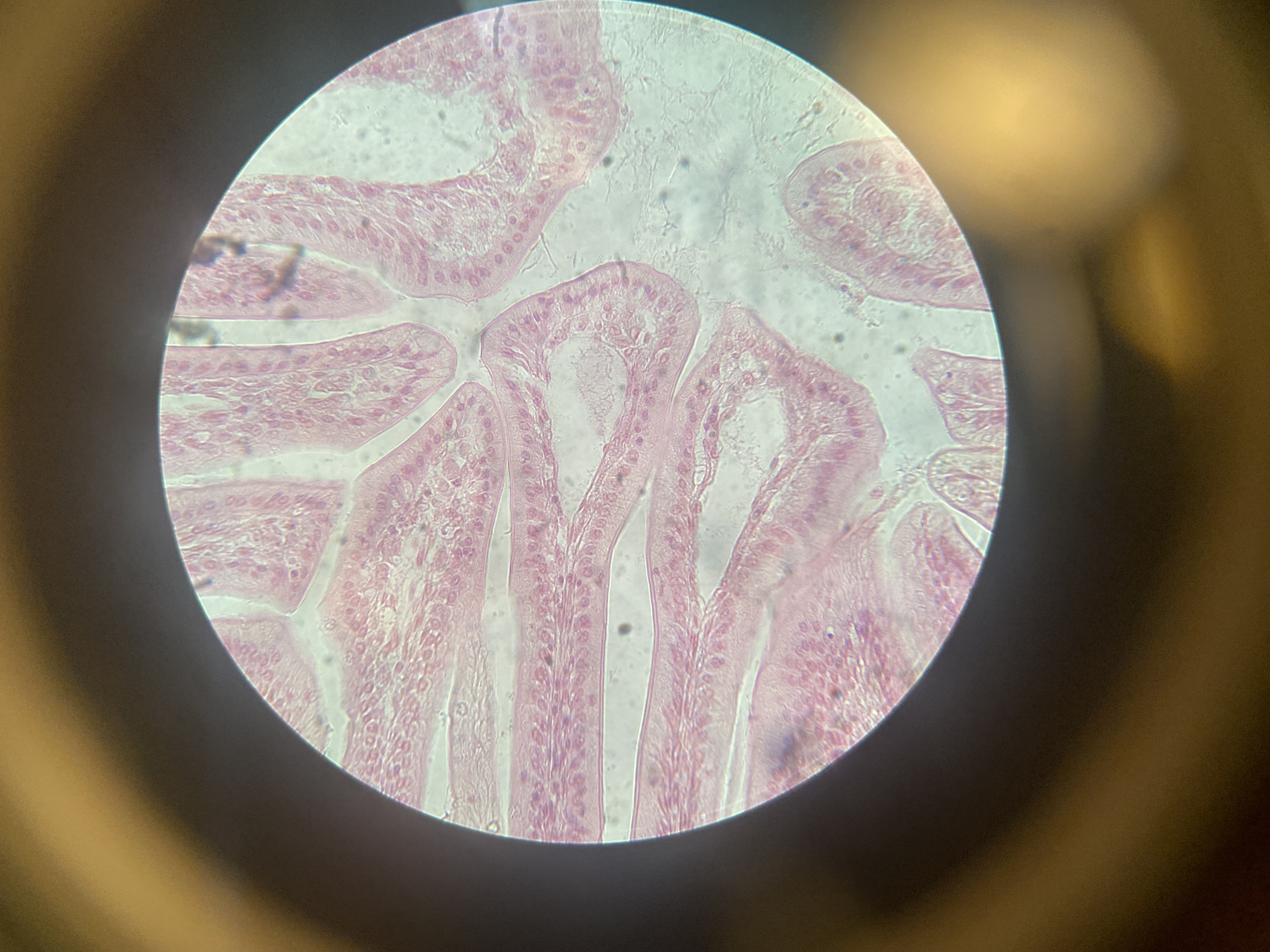 <p>Identify</p>