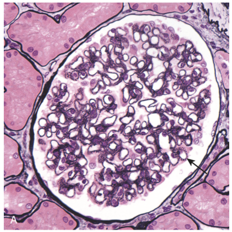 term image
