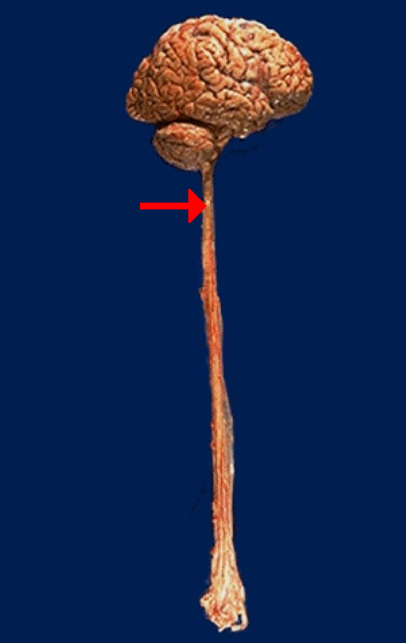<p>Specifically label this body structure</p>