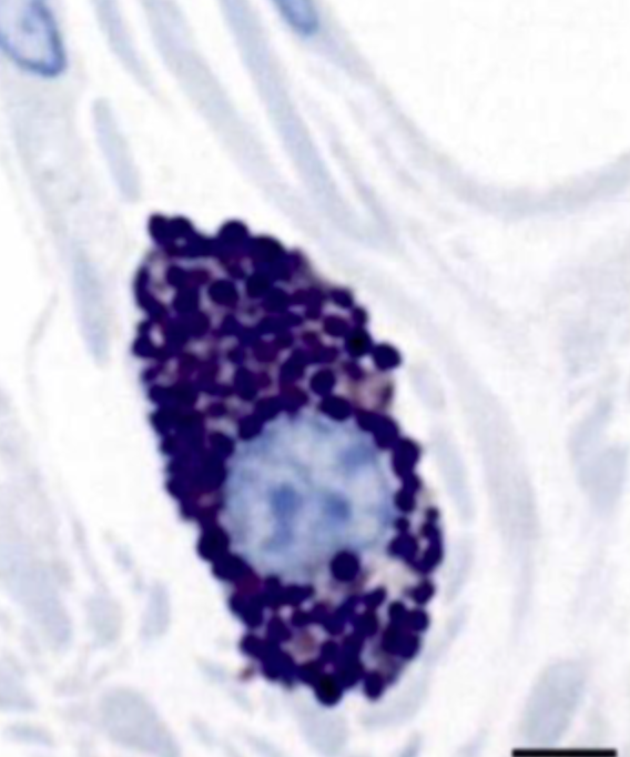 <p>Metakromasi (farveskift ved farvning) pga. heparin i granula.</p>