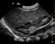 <p>What is the prominent structure seen here?</p>