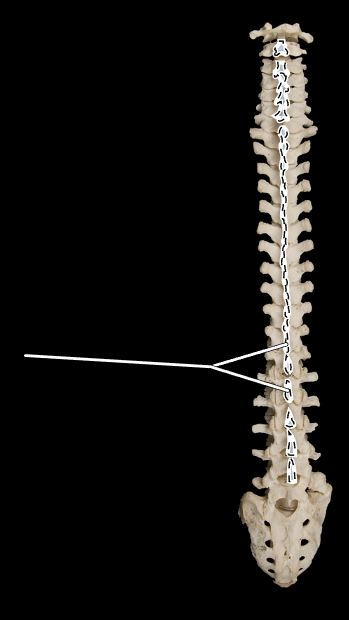 <p>What part of the vertebra is highlighted?</p><p>What is the proper name for this entire bone structure?</p><p>(Posterior view).</p>