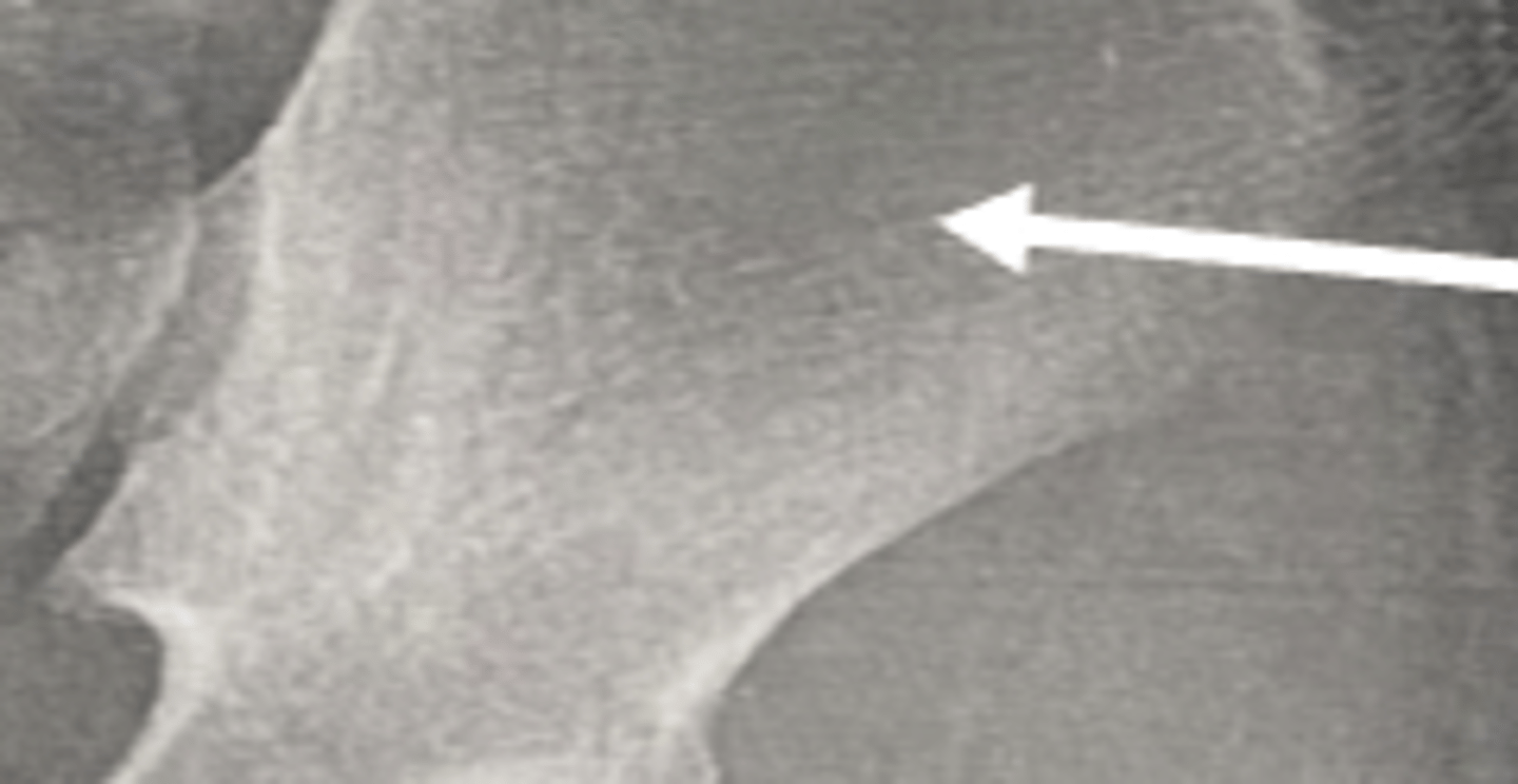 <p>ilium</p>