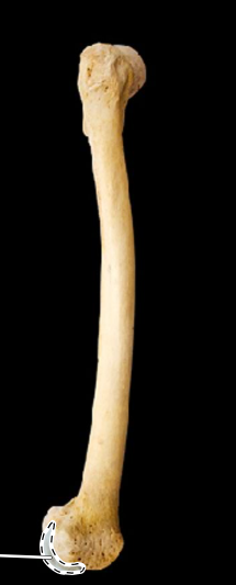 <p>Femur, lateral view, right side</p>